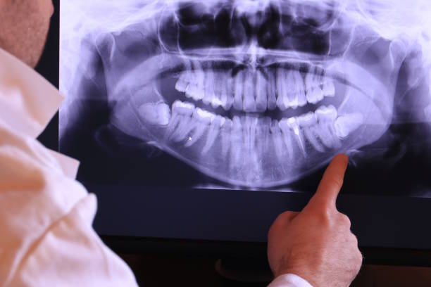 Best Emergency Tooth Extraction in Marfa, TX