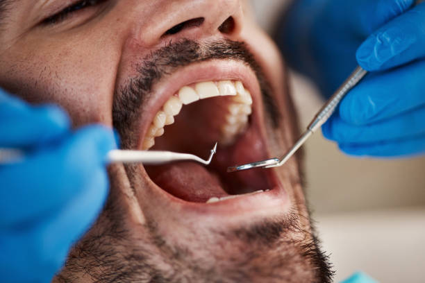 Best Emergency Denture Repair in Marfa, TX