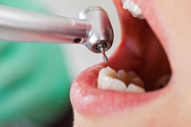 Best Same-Day Emergency Dental Services in Marfa, TX